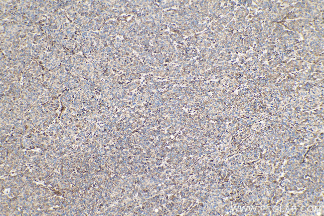 MAGEC2 Antibody in Immunohistochemistry (Paraffin) (IHC (P))