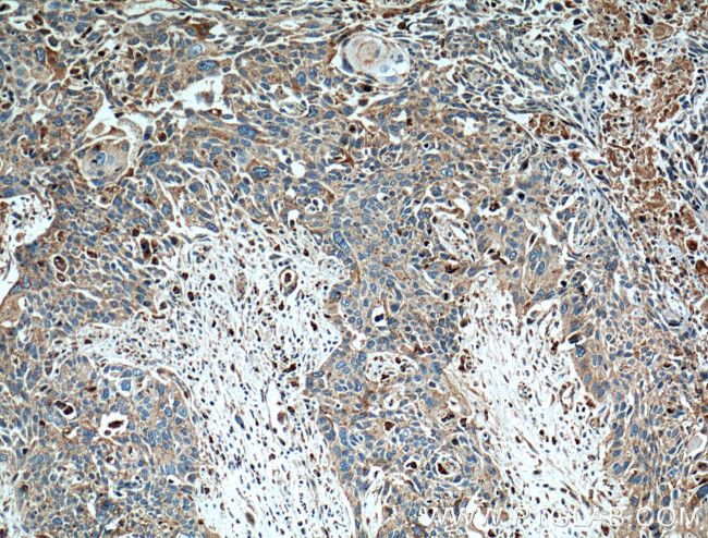 LGALS3BP Antibody in Immunohistochemistry (Paraffin) (IHC (P))