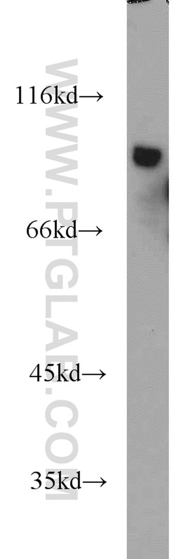 LGALS3BP Antibody in Western Blot (WB)