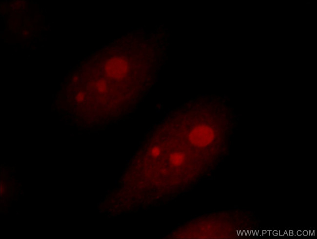 AATF Antibody in Immunocytochemistry (ICC/IF)