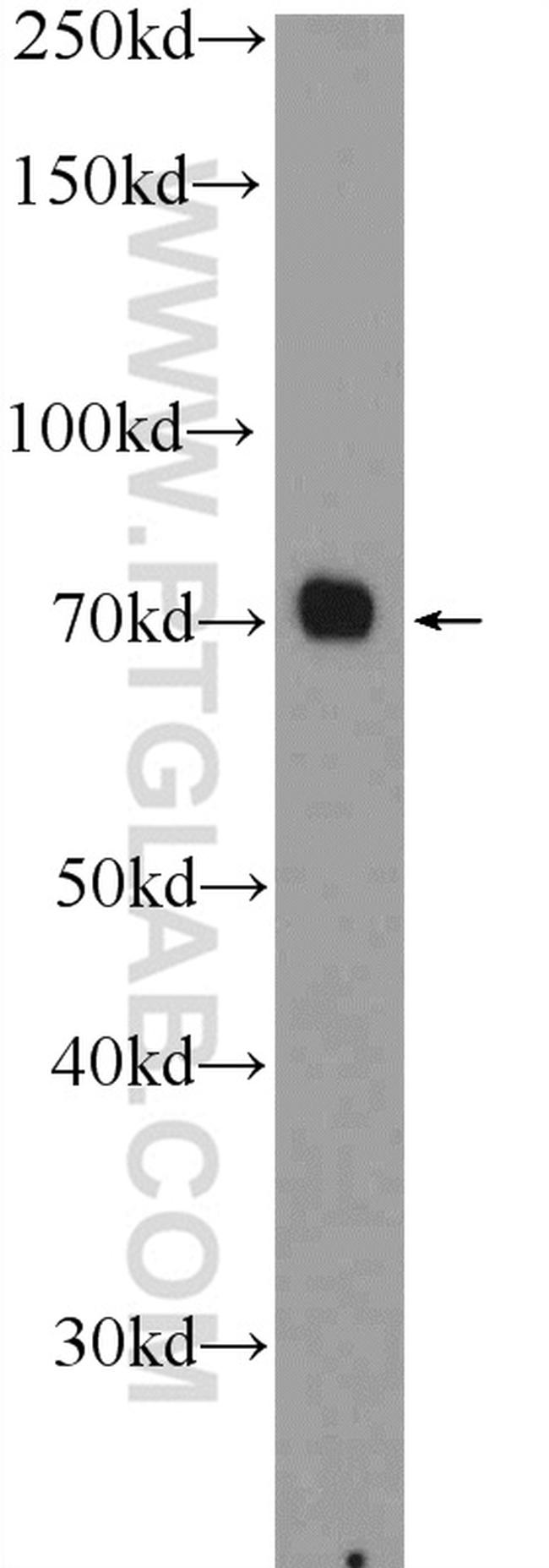 AATF Antibody in Western Blot (WB)