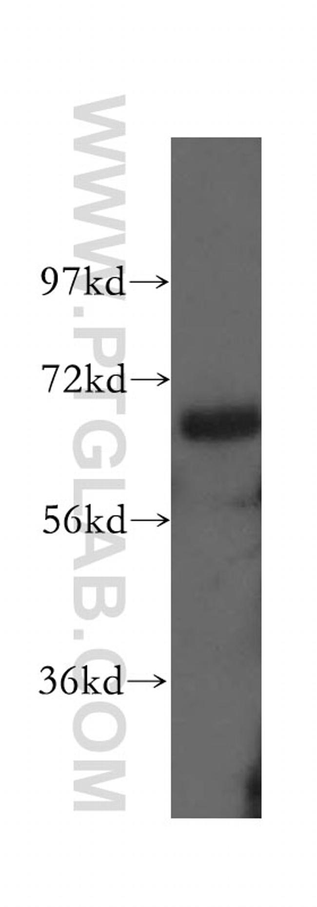 AATF Antibody in Western Blot (WB)