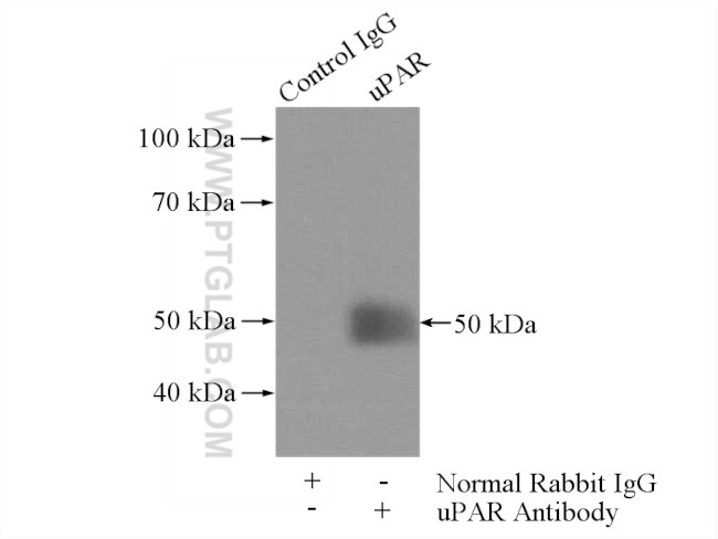 uPAR Antibody in Immunoprecipitation (IP)