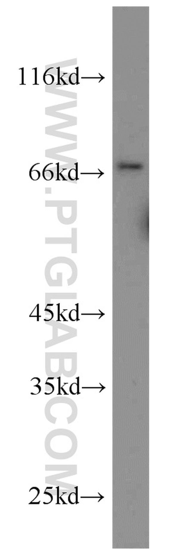 uPAR Antibody in Western Blot (WB)