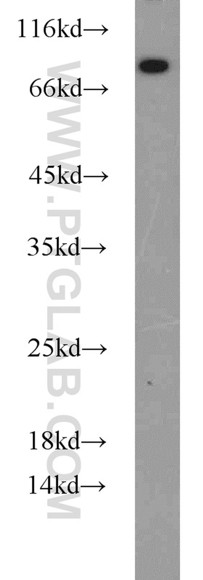 CYPC Antibody in Western Blot (WB)