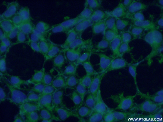 CYPC Antibody in Immunocytochemistry (ICC/IF)