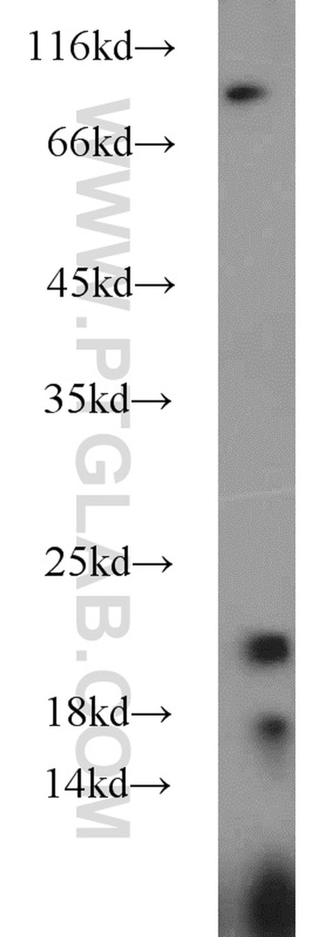 CYPC Antibody in Western Blot (WB)