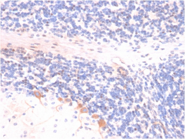 p14ARF Antibody in Immunohistochemistry (Paraffin) (IHC (P))