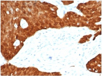 P16INK4a Antibody in Immunohistochemistry (Paraffin) (IHC (P))