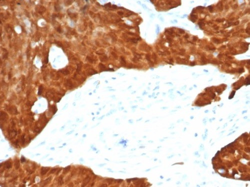 P16INK4a Antibody in Immunohistochemistry (Paraffin) (IHC (P))