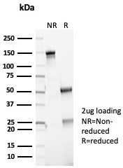 P16INK4a Antibody in SDS-PAGE (SDS-PAGE)