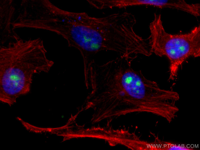 EIF6 Antibody in Immunocytochemistry (ICC/IF)