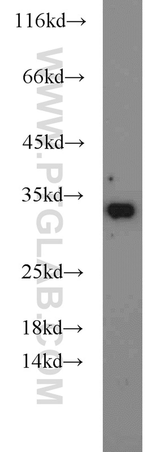 EIF6 Antibody in Western Blot (WB)