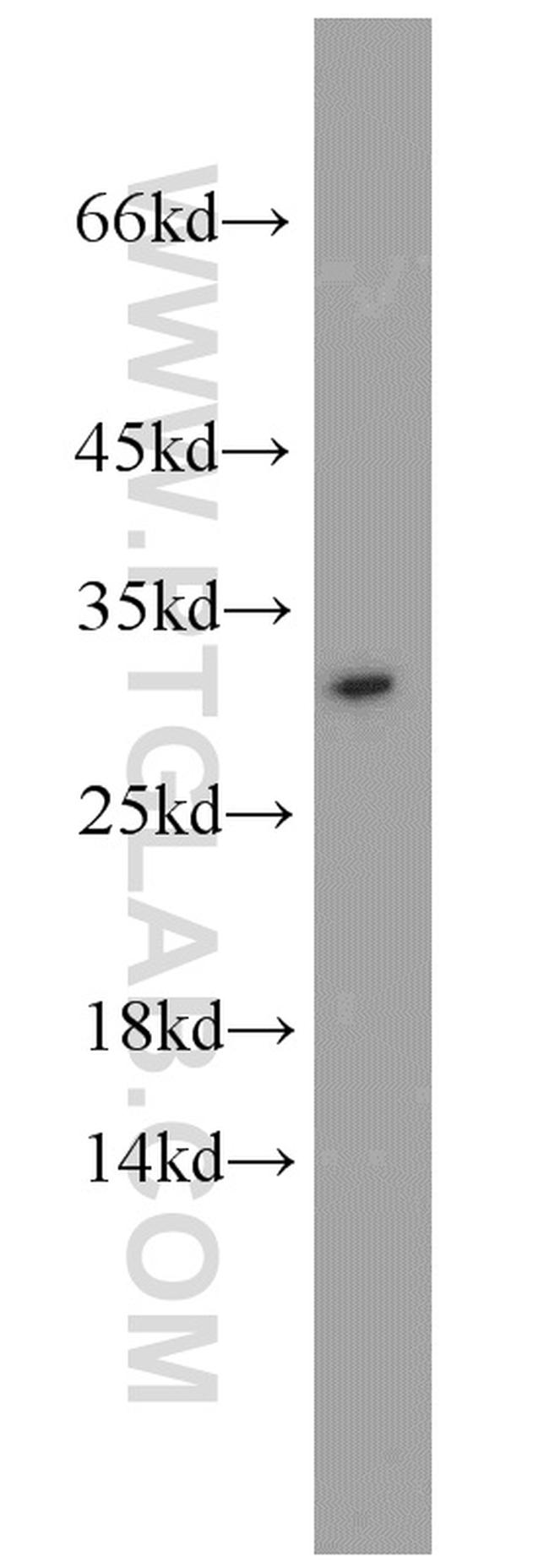 EIF6 Antibody in Western Blot (WB)