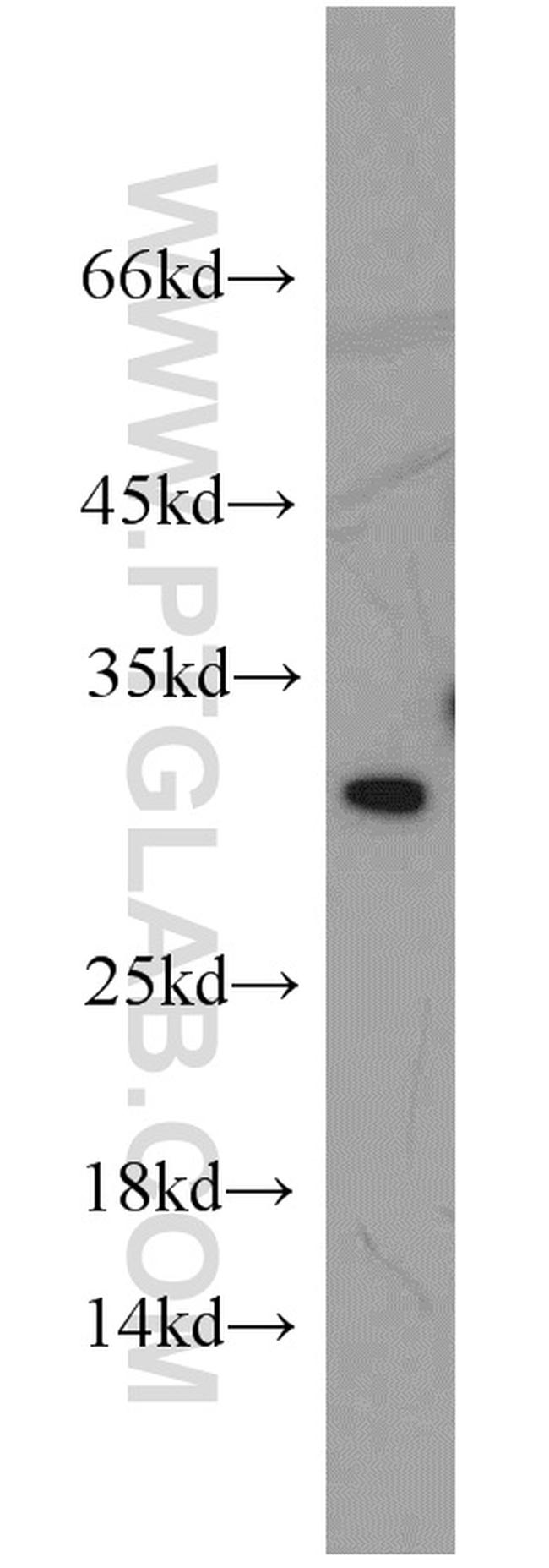 EIF6 Antibody in Western Blot (WB)