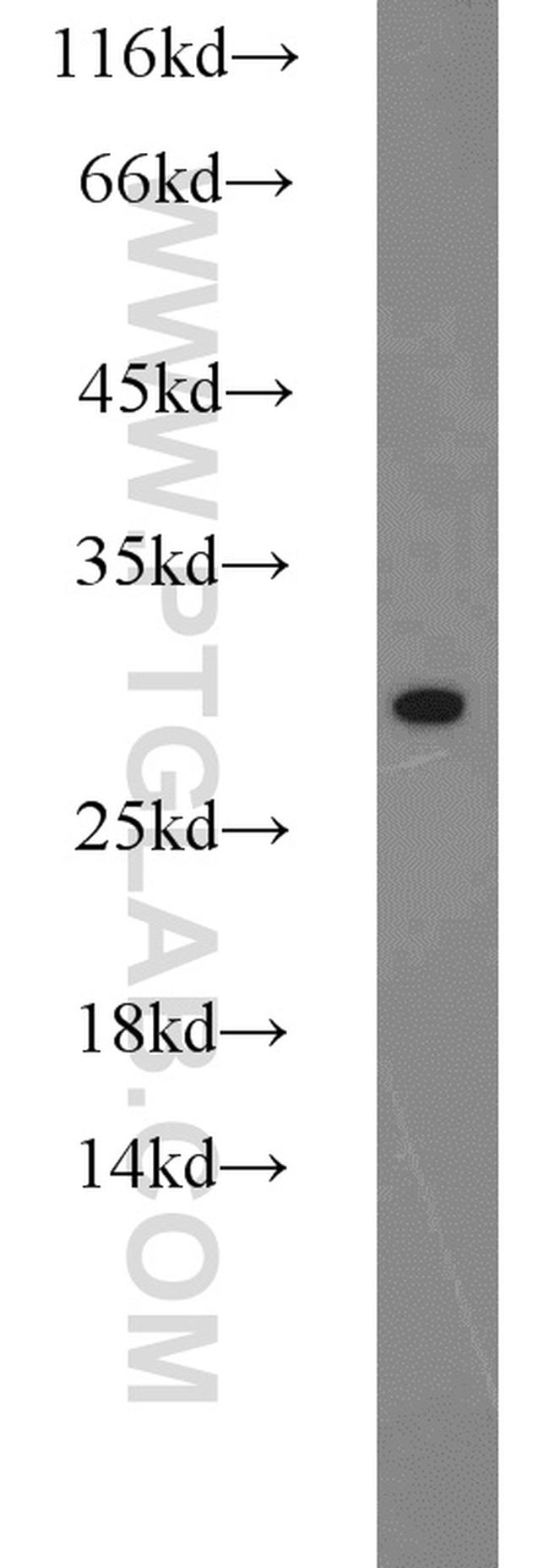 EIF6 Antibody in Western Blot (WB)