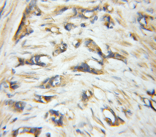 EIF6 Antibody in Immunohistochemistry (Paraffin) (IHC (P))