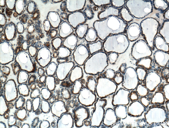 calreticulin Antibody in Immunohistochemistry (Paraffin) (IHC (P))