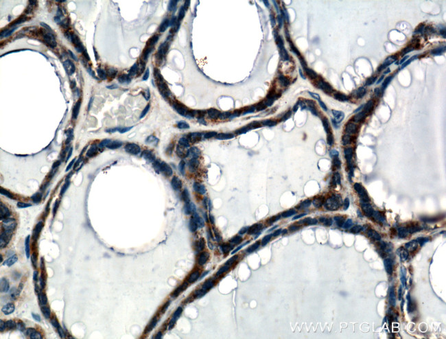 calreticulin Antibody in Immunohistochemistry (Paraffin) (IHC (P))