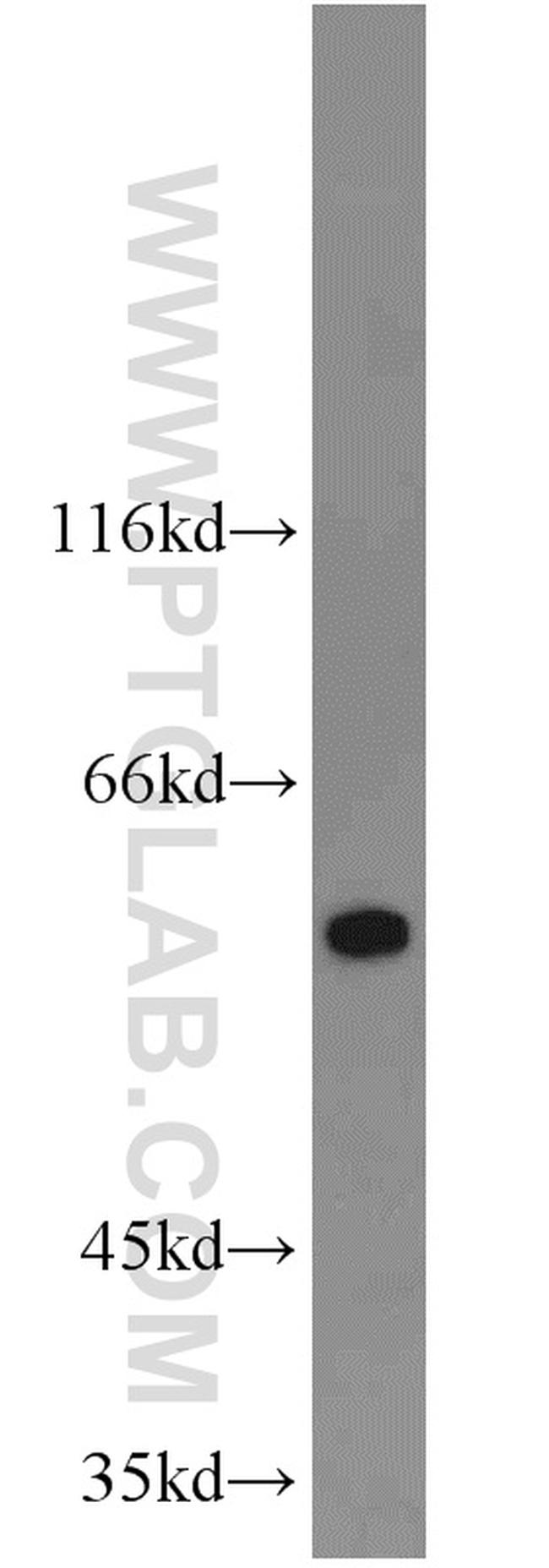 calreticulin Antibody in Western Blot (WB)