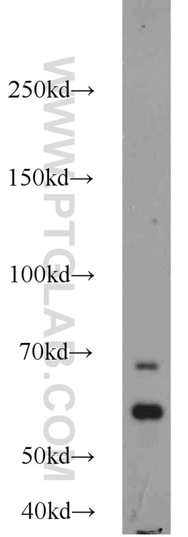 calreticulin Antibody in Western Blot (WB)