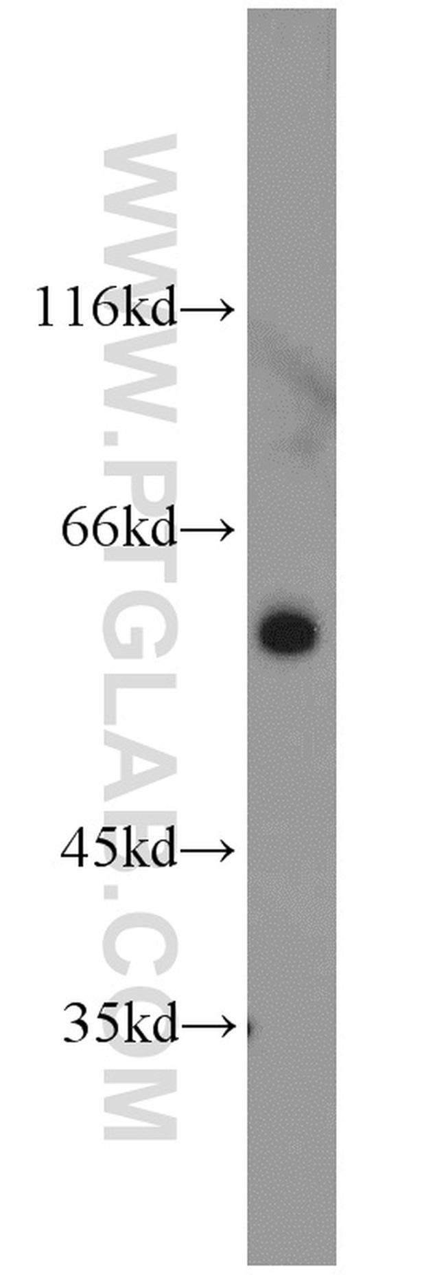 calreticulin Antibody in Western Blot (WB)