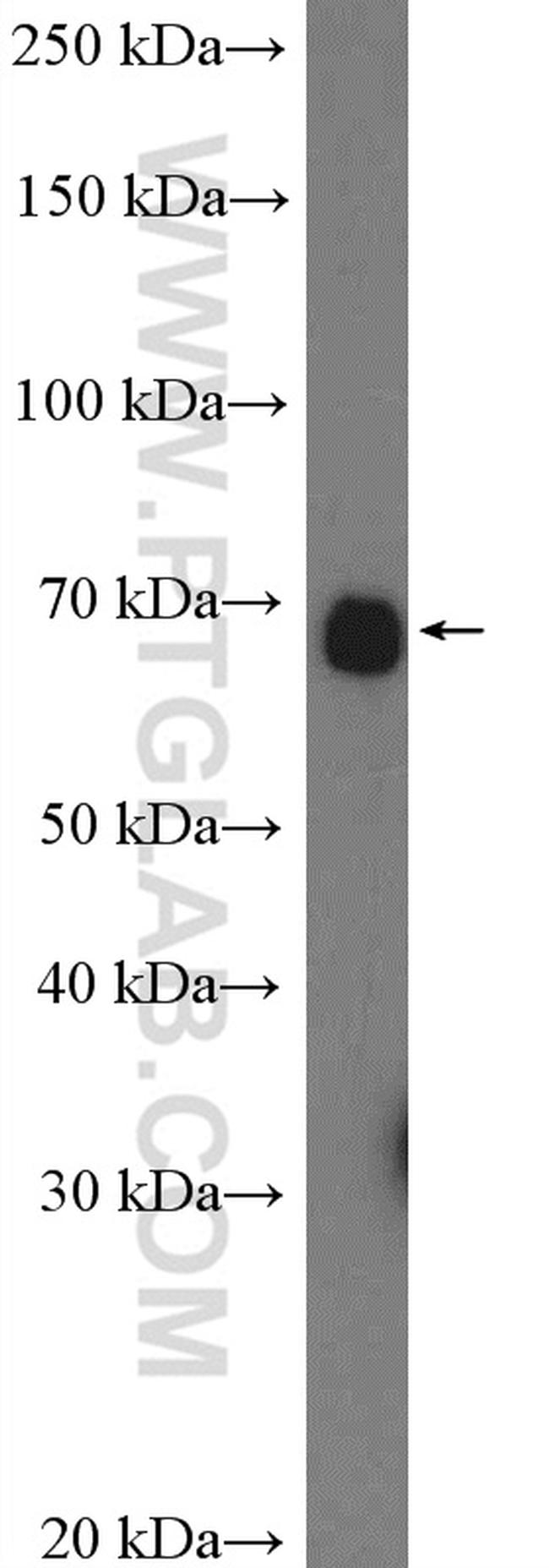 calreticulin Antibody in Western Blot (WB)