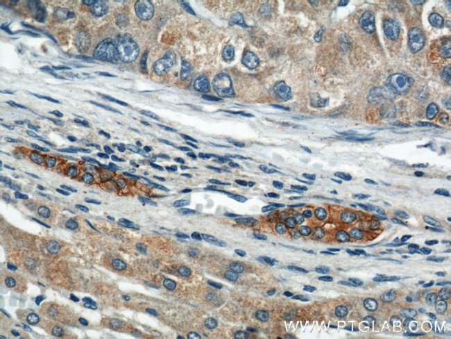 CCM3/PDCD10 Antibody in Immunohistochemistry (Paraffin) (IHC (P))