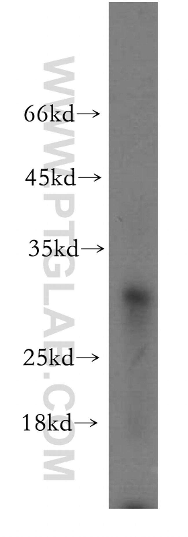 CCM3/PDCD10 Antibody in Western Blot (WB)