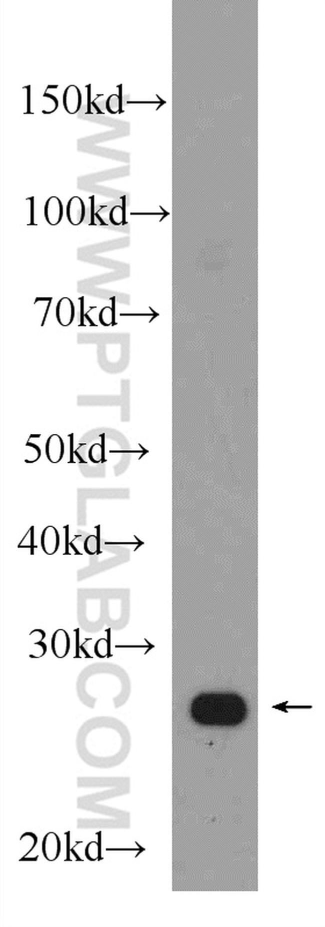 CCM3/PDCD10 Antibody in Western Blot (WB)