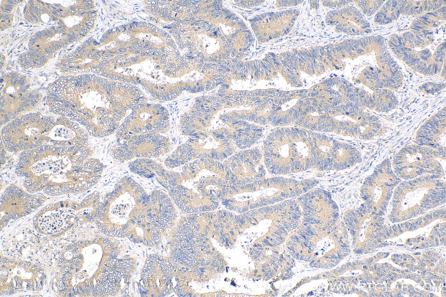 CCM3/PDCD10 Antibody in Immunohistochemistry (Paraffin) (IHC (P))