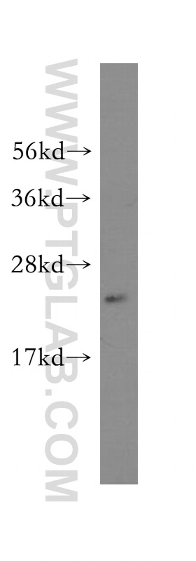 CCM3/PDCD10 Antibody in Western Blot (WB)