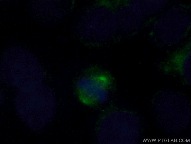 Aurora A Antibody in Immunocytochemistry (ICC/IF)