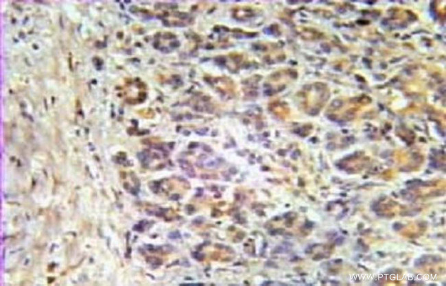 Aurora A Antibody in Immunohistochemistry (Paraffin) (IHC (P))