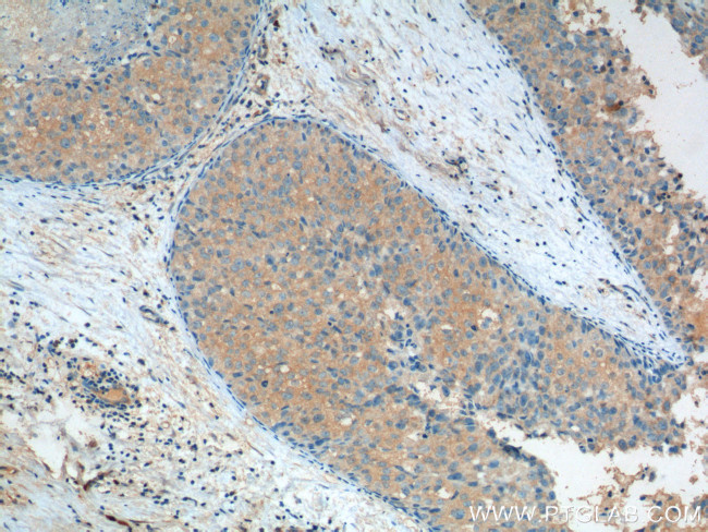 Aurora A Antibody in Immunohistochemistry (Paraffin) (IHC (P))