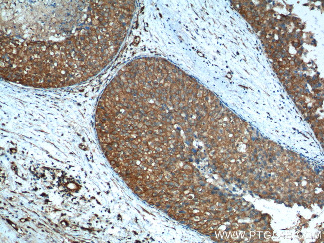 Aurora A Antibody in Immunohistochemistry (Paraffin) (IHC (P))