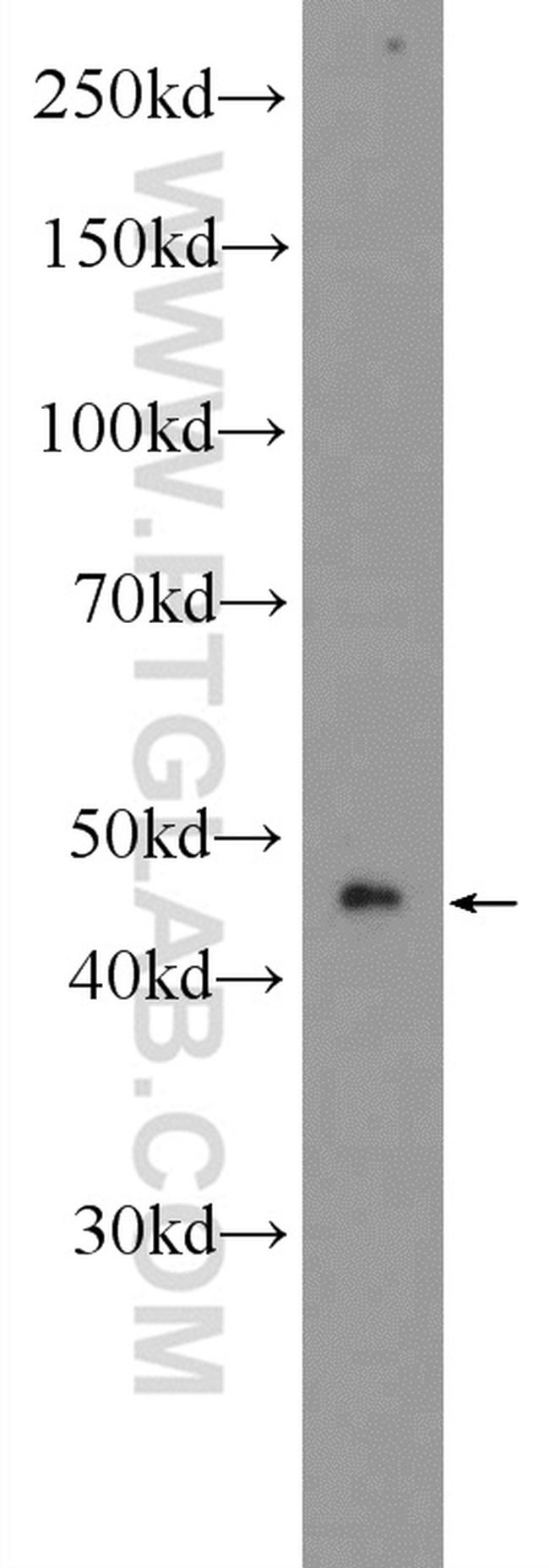 Aurora A Antibody in Western Blot (WB)