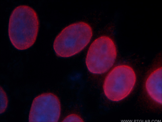 Lamin A/C Antibody in Immunocytochemistry (ICC/IF)