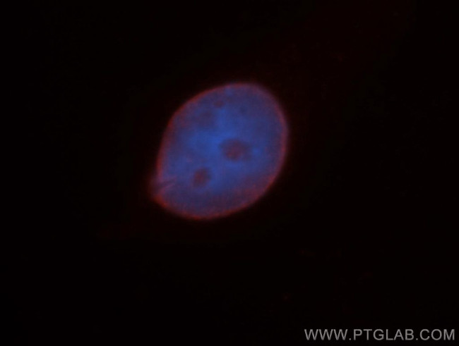 Lamin A/C Antibody in Immunocytochemistry (ICC/IF)