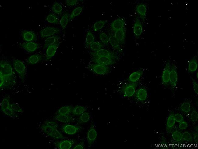 Lamin A/C Antibody in Immunocytochemistry (ICC/IF)