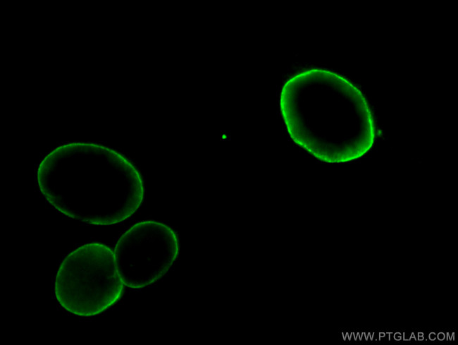 Lamin A/C Antibody in Immunocytochemistry (ICC/IF)