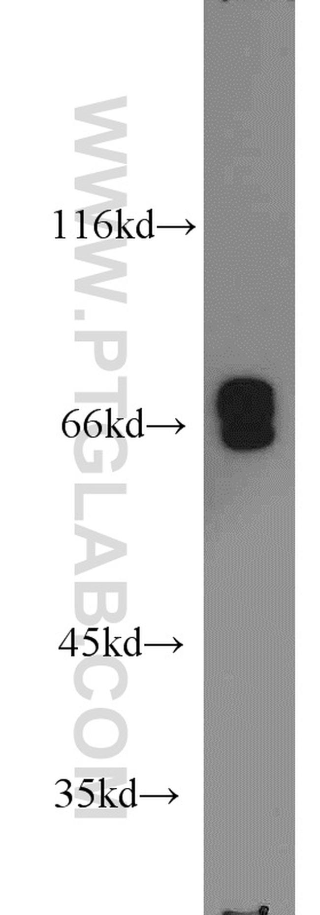 Lamin A/C Antibody in Western Blot (WB)