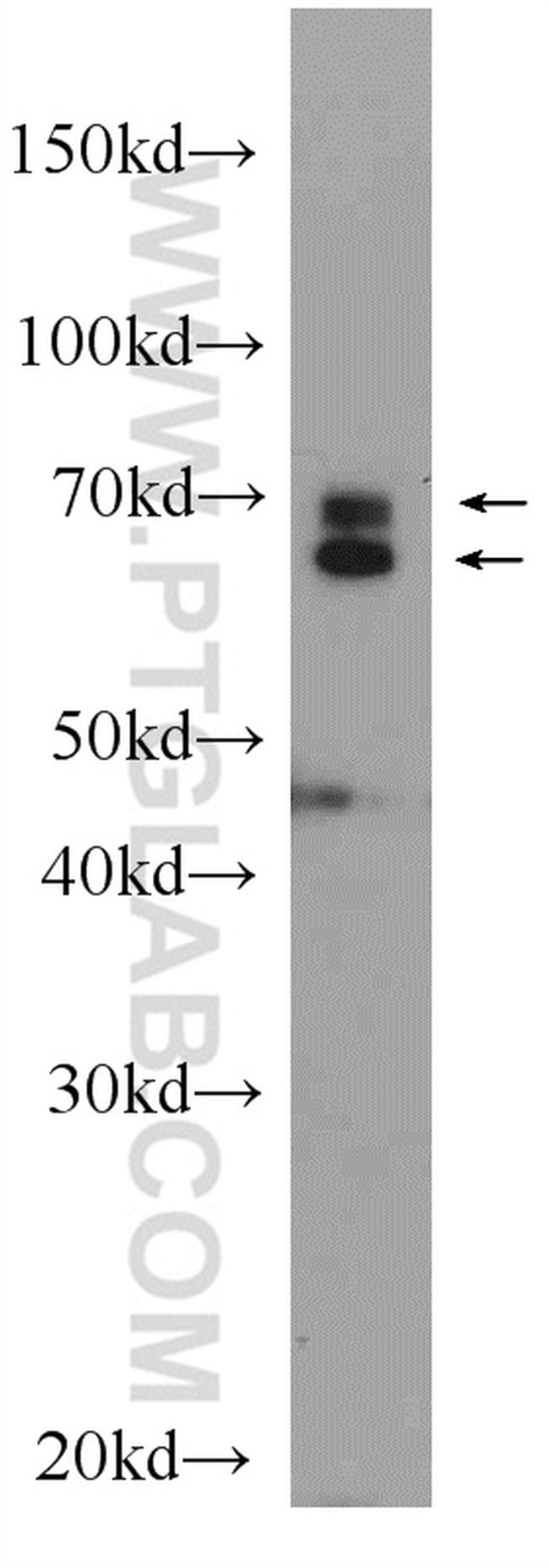 Lamin A/C Antibody in Western Blot (WB)