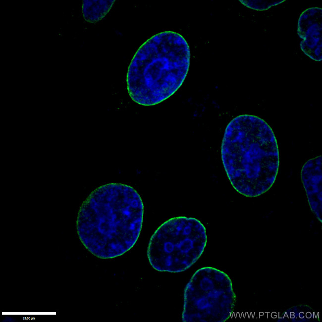 Lamin A/C Antibody in Immunocytochemistry (ICC/IF)