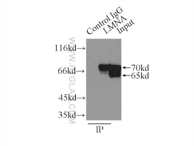 Lamin A/C Antibody in Immunoprecipitation (IP)