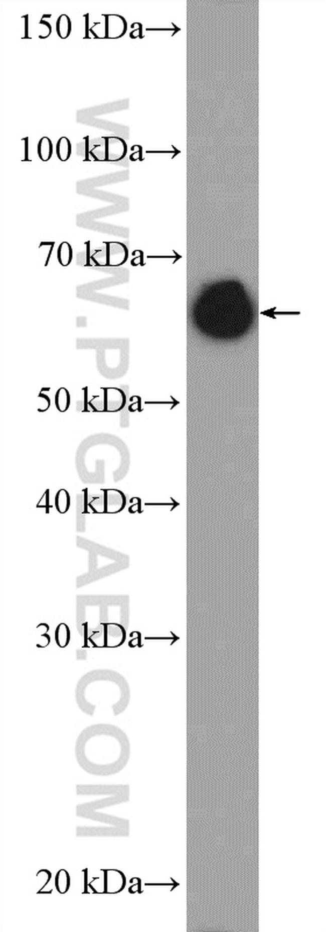 Lamin A/C Antibody in Western Blot (WB)