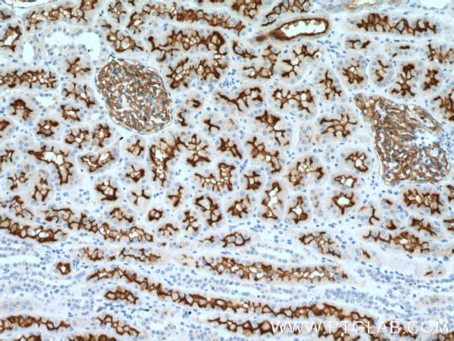 MME/CD10 Antibody in Immunohistochemistry (Paraffin) (IHC (P))