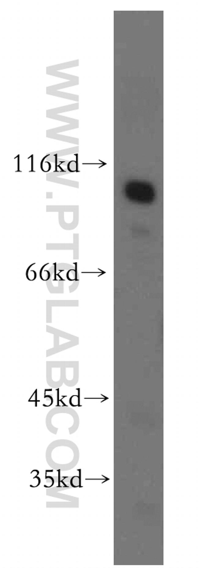 MME/CD10 Antibody in Western Blot (WB)