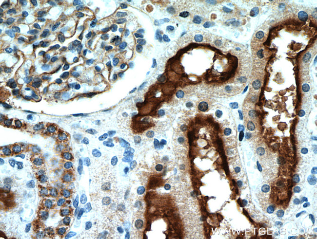 MME/CD10 Antibody in Immunohistochemistry (Paraffin) (IHC (P))