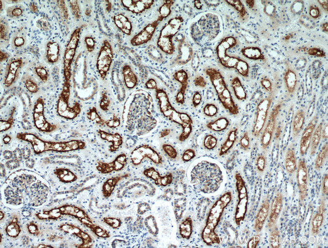 MME/CD10 Antibody in Immunohistochemistry (Paraffin) (IHC (P))